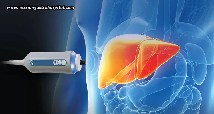 FibroScan Liver Test
